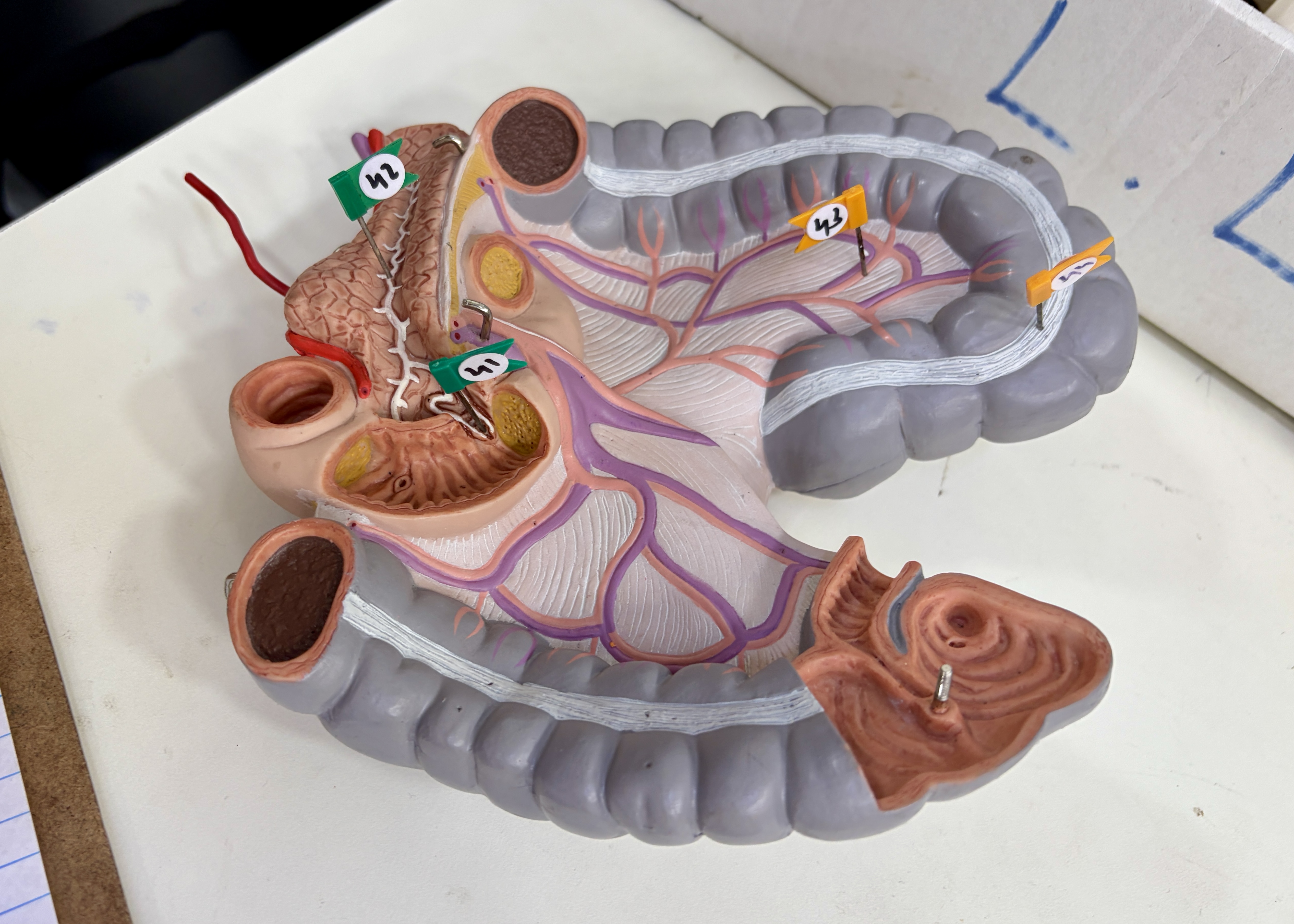 Major duodenal papilla (41), Pancreatic duct (42), Sigmoid artery (43)