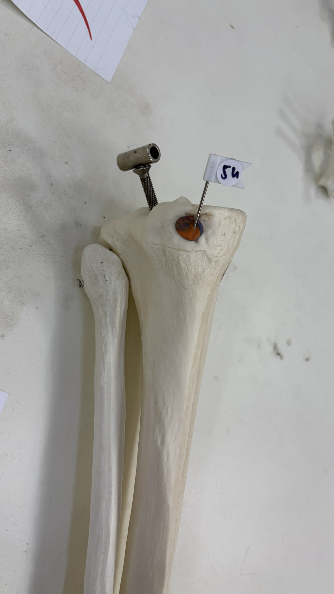 54 - Groove for Semimembranosus