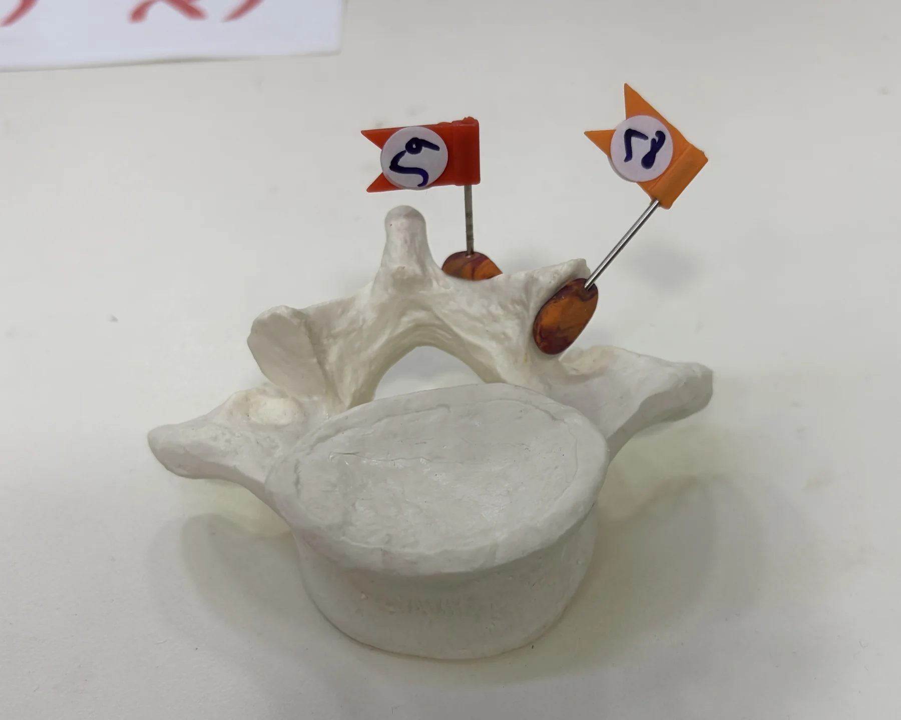 Lamina - 59, Inferior articular facet - 58