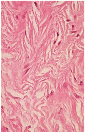 Dense connective tissue