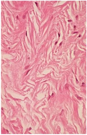 Dense connective tissue