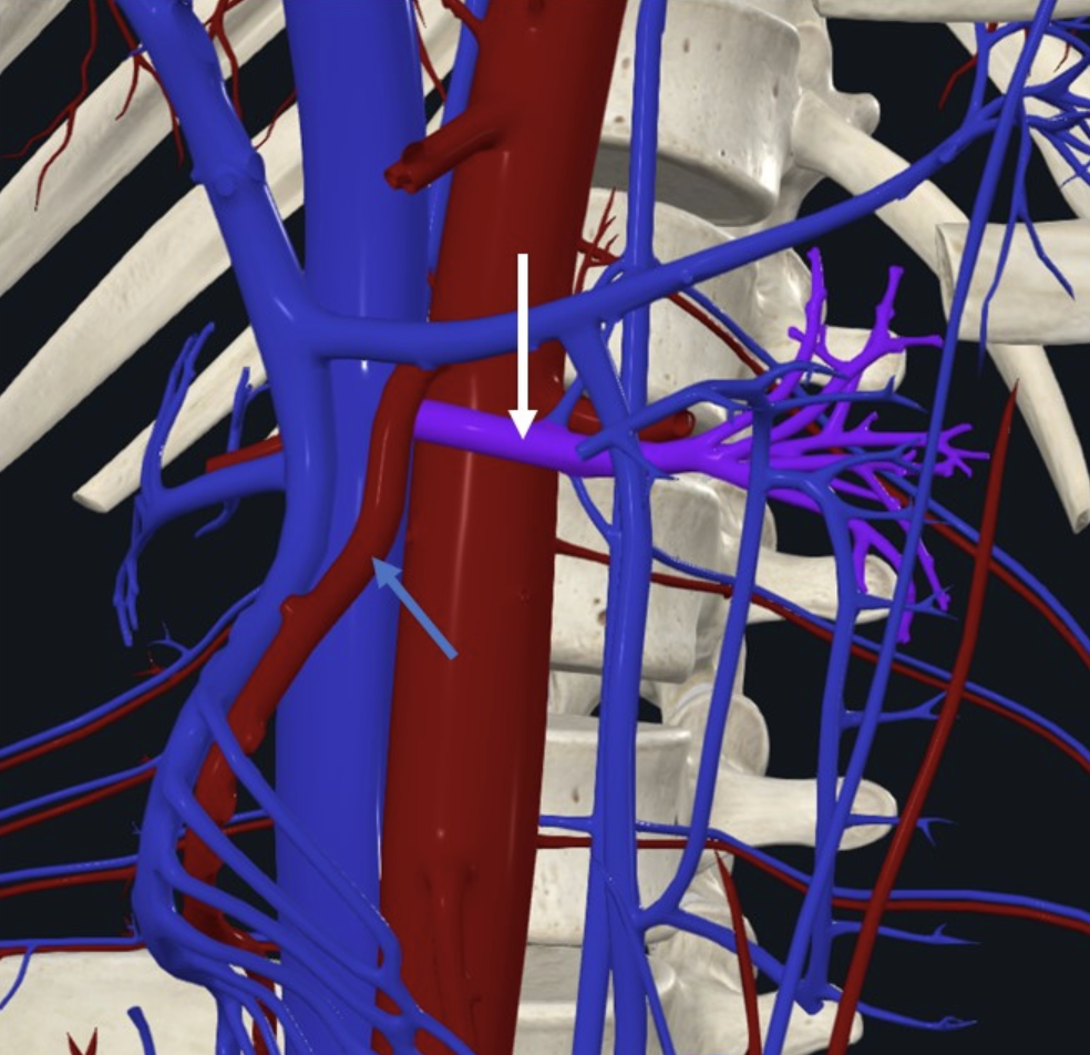 Left renal vein (חץ לבן), SMA (חץ כחול)
