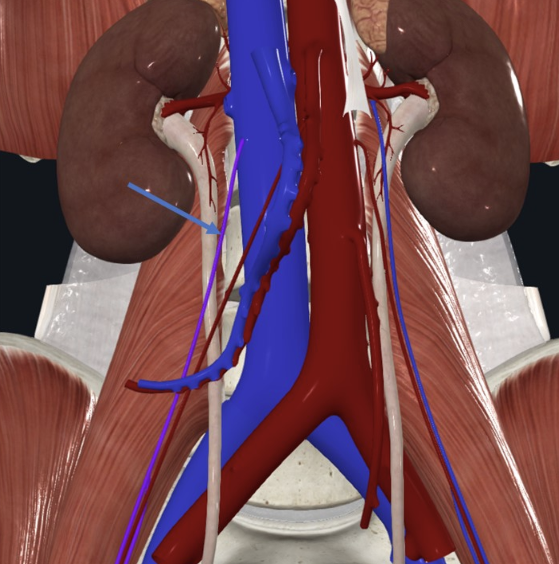 Right Testicular Vein