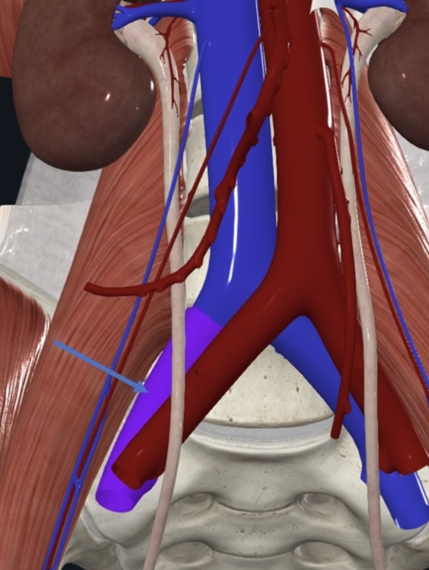 Right Common Iliac Vein
