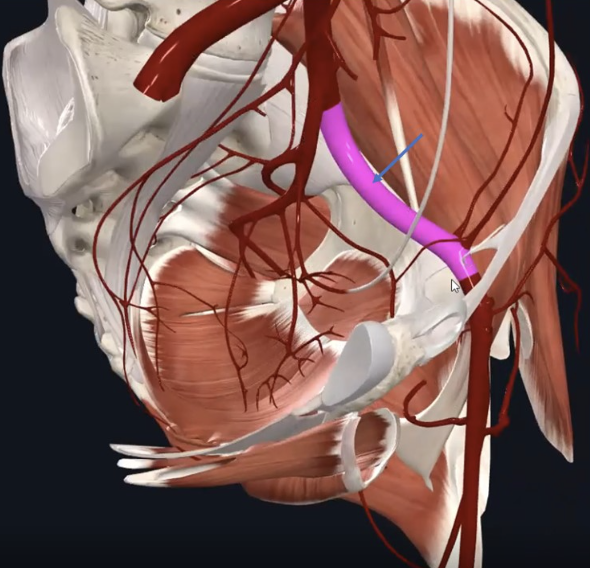 Left External iliac artery