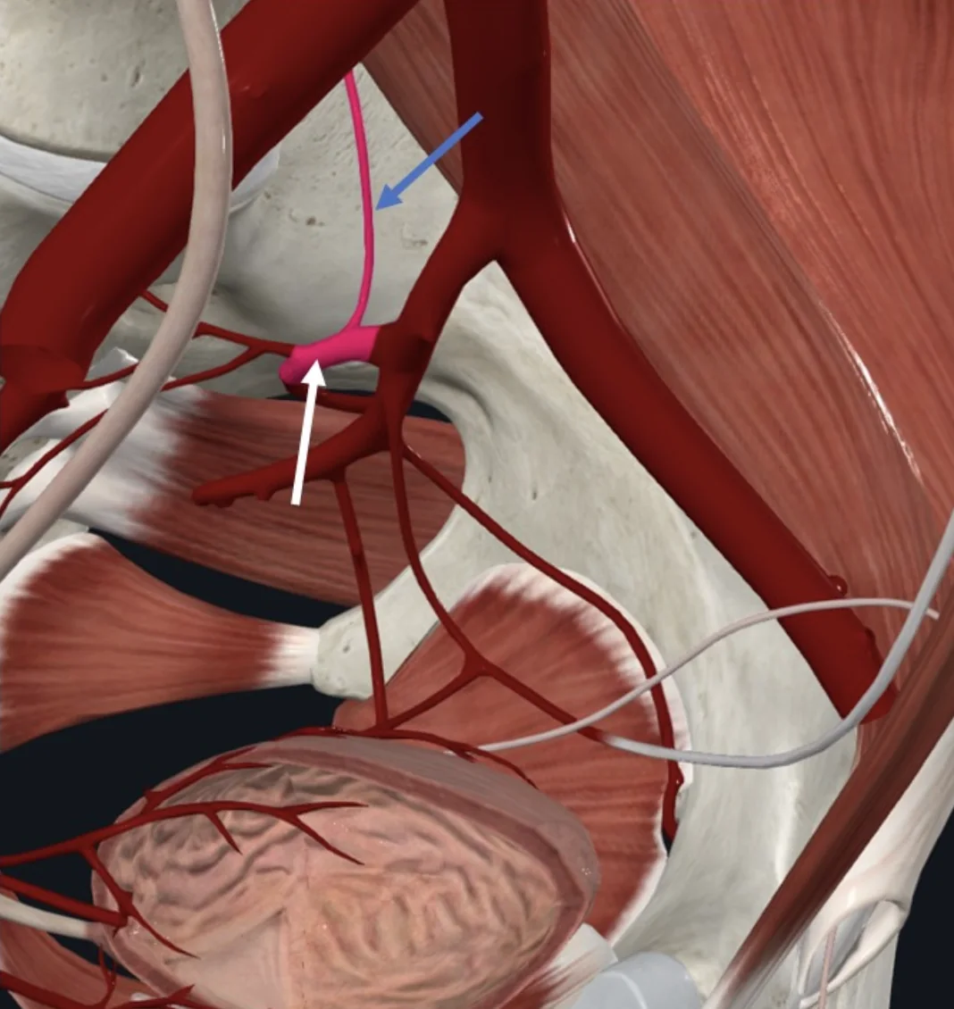 Iliolumbar Artery (חץ כחול). ה־Posterior division של ה־Internal Iliac Artery (חץ לבן)