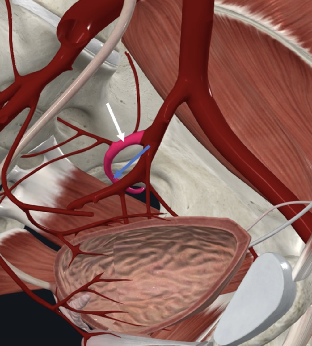 Superior Gluteal artery (חץ כחול), הוא המשכו הישיר של ה־Posterior division