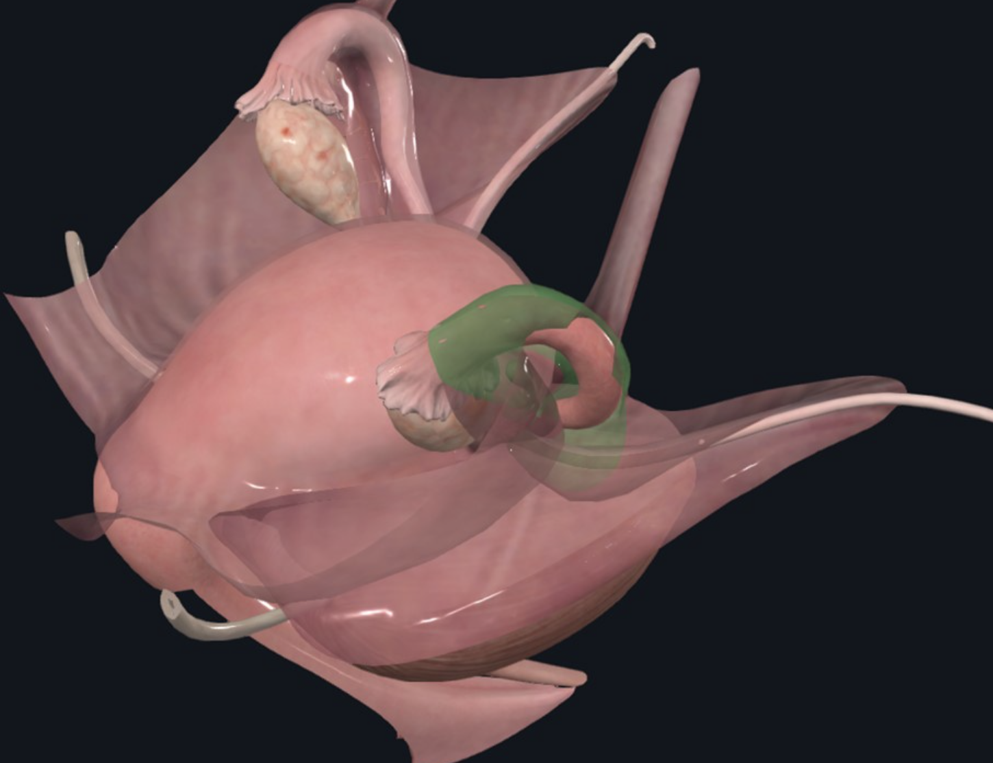 Mesosalpinx, חלקה של ה־Broad ligament הנאחז בחצוצרה