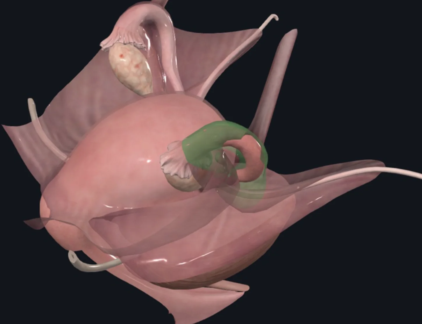 Mesosalpinx, חלקה של ה־Broad ligament הנאחז בחצוצרה