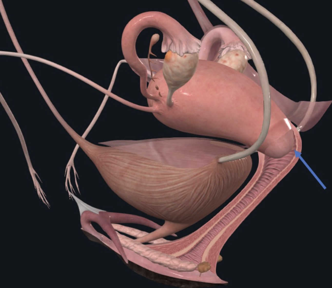 Posterior Fornix