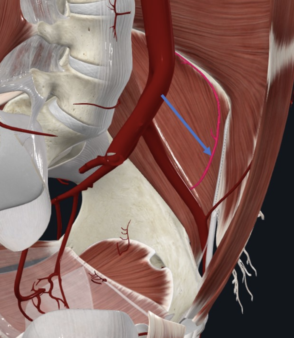 Deep Circumflex Iliac Artery (חץ כחול), מקורו ב־External iliac artery והוא מקיף את ה־Iliac fossa
