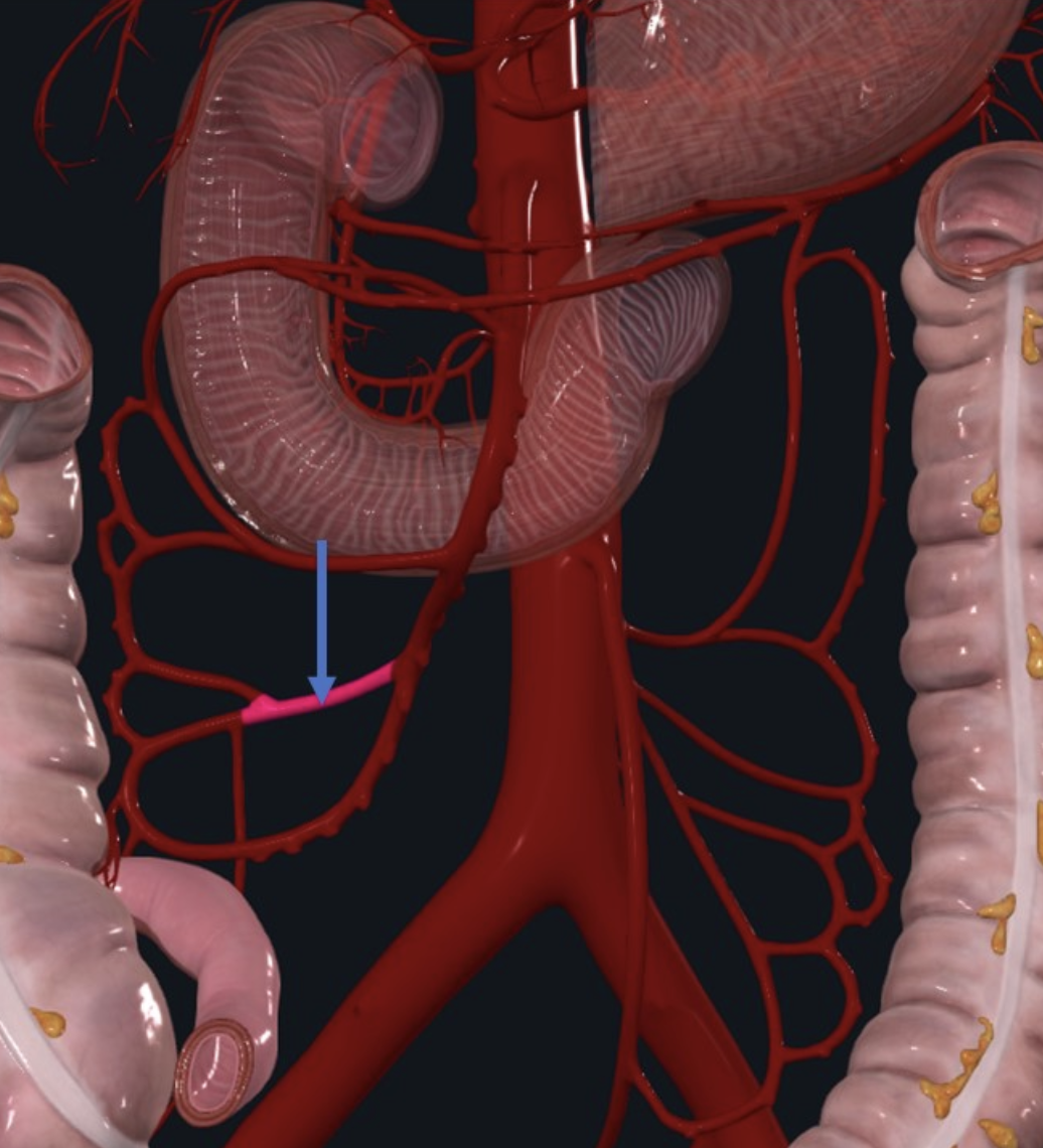 Ileocolic Artery