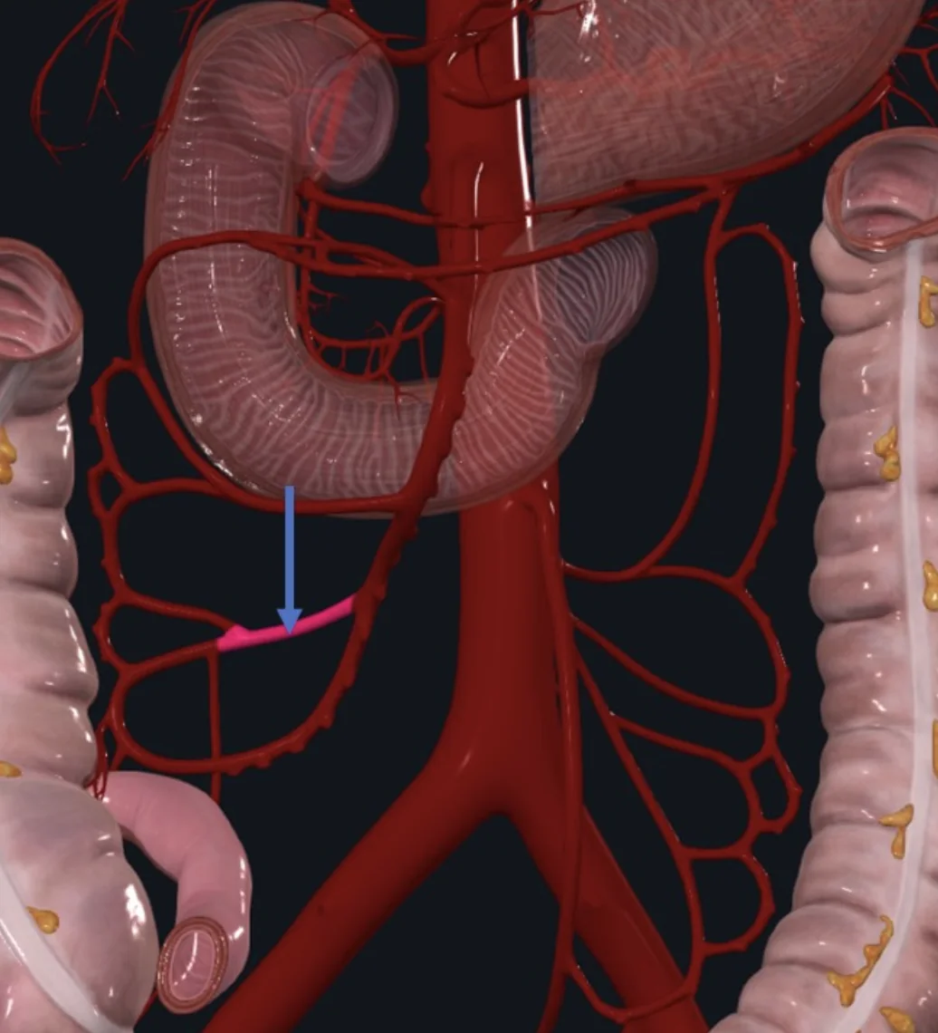 Ileocolic Artery