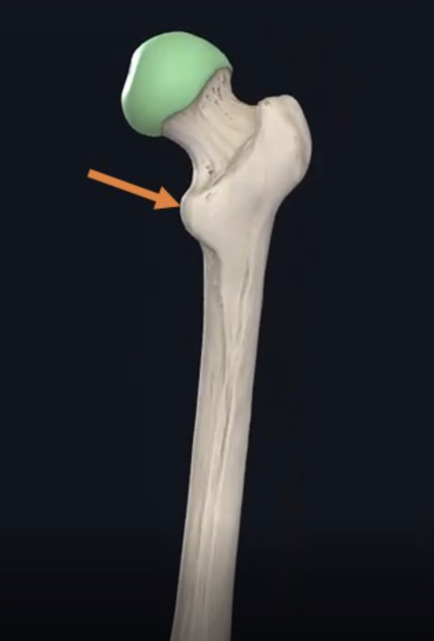 Lesser trochanter, נקודת האחיזה של ה־Iliopsoas muscle