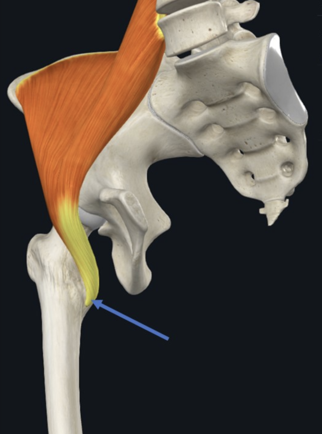 Iliopsoas נאחז ב־Lesser trochanter