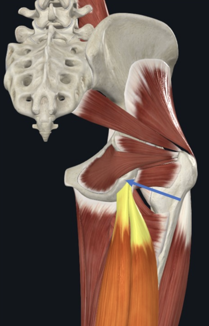 קבוצת שרירי ה־Hamstrings מונה שלושה שרירים: Smimembranosus, Semitendinosus, Biceps femoris. כל השלושה נאחזים פרוקסימלית ב־Ischial tuberosity