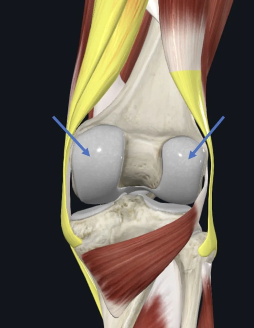 Femoral Condyles, מימין אחיזת ה־Biceps femoris בראש עצם הפיבולה; משמאל, אחיזה ה־Semimembranosus and Semitendinosus בעצם הטיביה