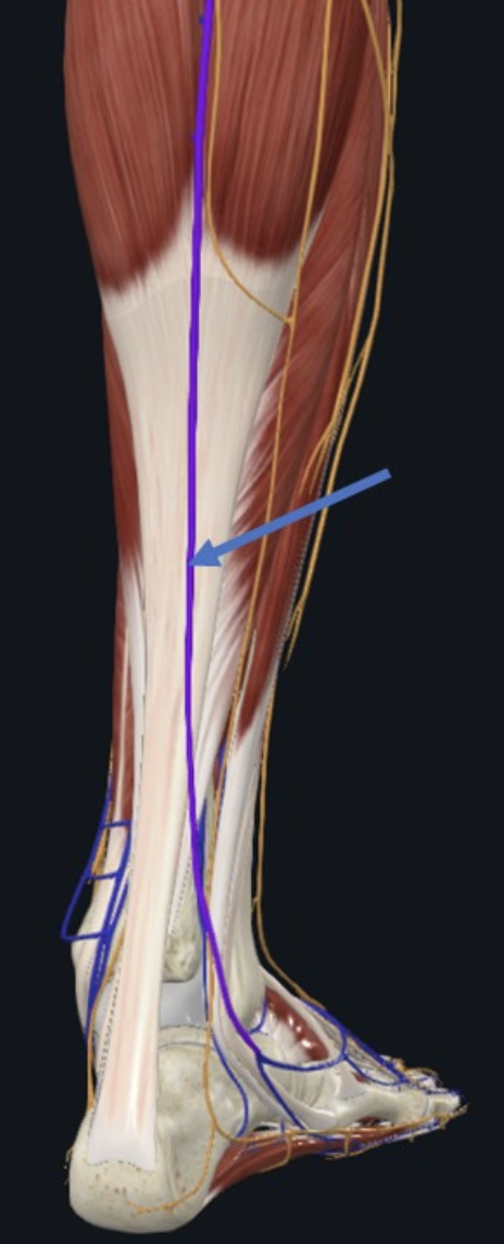 Small Saphenous Vein, וריד שטחי העובר במסלולו באזור הפוסטריורי של השוק