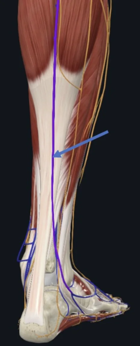 Small Saphenous Vein, וריד שטחי העובר במסלולו באזור הפוסטריורי של השוק