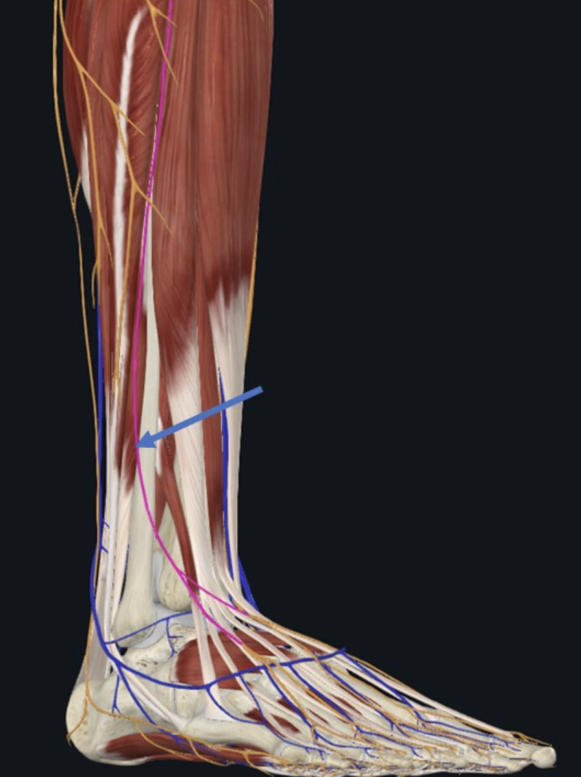 Superficial Fibular Nerve, פיצול של ה־Common fibular nerve, עובר באזור האנטרו־לטרלי של השוק וגב כף הרגל