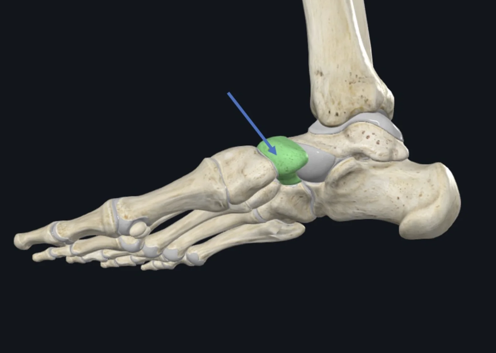 Navicular