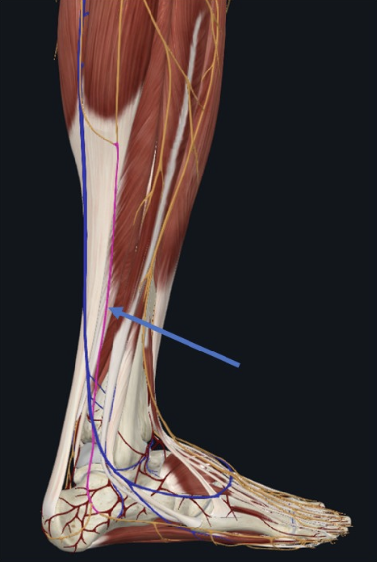 Sural Nerve, סנסורי שמקורו ב־Tibial nוב־Common fibular nerve, חולף בצמידות ל־Small saphenous v שטחית למדור הפוסטריורי של השוק