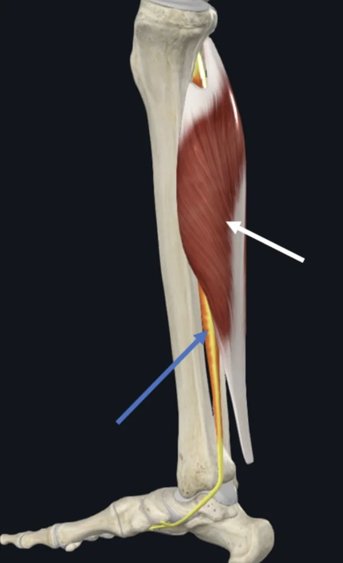 Tibialis Posterior (חץ כחול), משתייך למדור הפוסטריורי העמוק של השוק ונמצא עמוק לשריר ה־Soleus