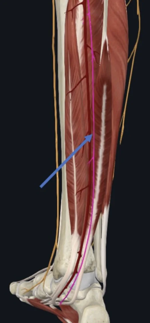 Tibial Nerve, מתקדם לאורך מסלולו עם ה־Posterior tibial a. בין המדור הפוסטריורי השטחי בשוק למדור הפוסטריורי העמוק