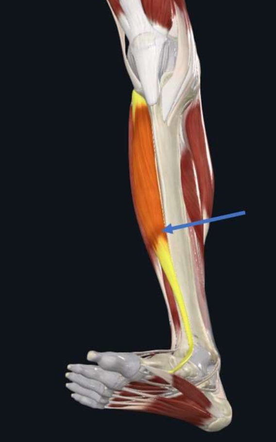 Tibialis Anterior