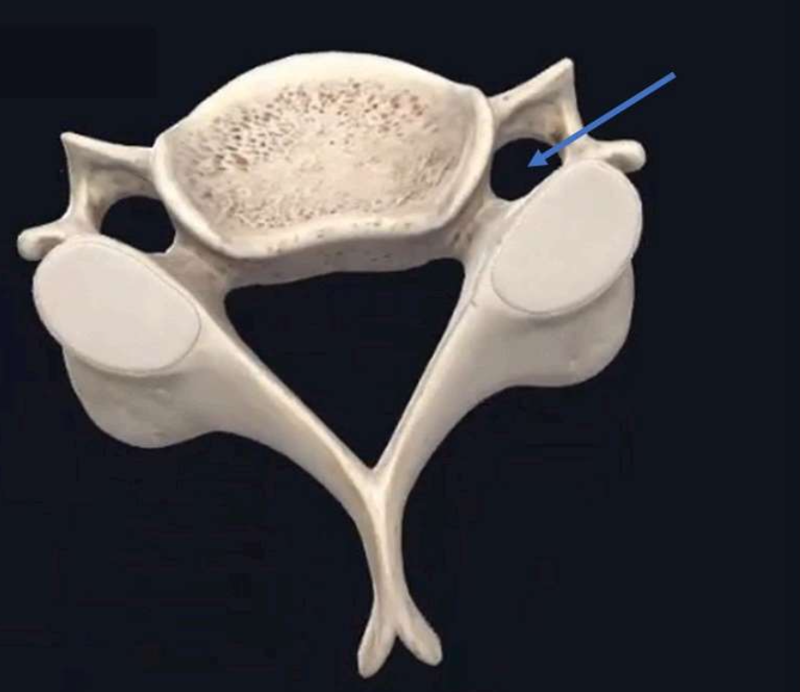 Vertebral Artery location