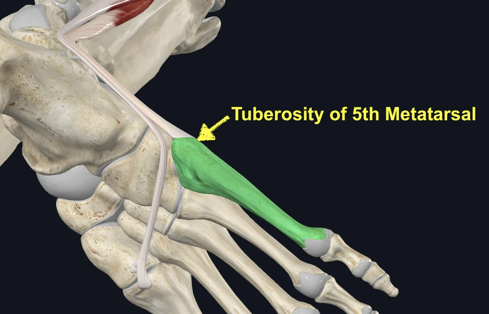 Tuberosity of 5th Metatarsal