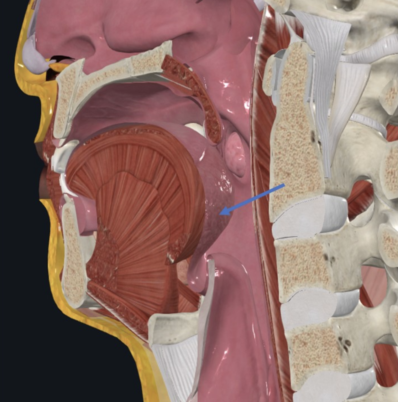 Lingual tonsil