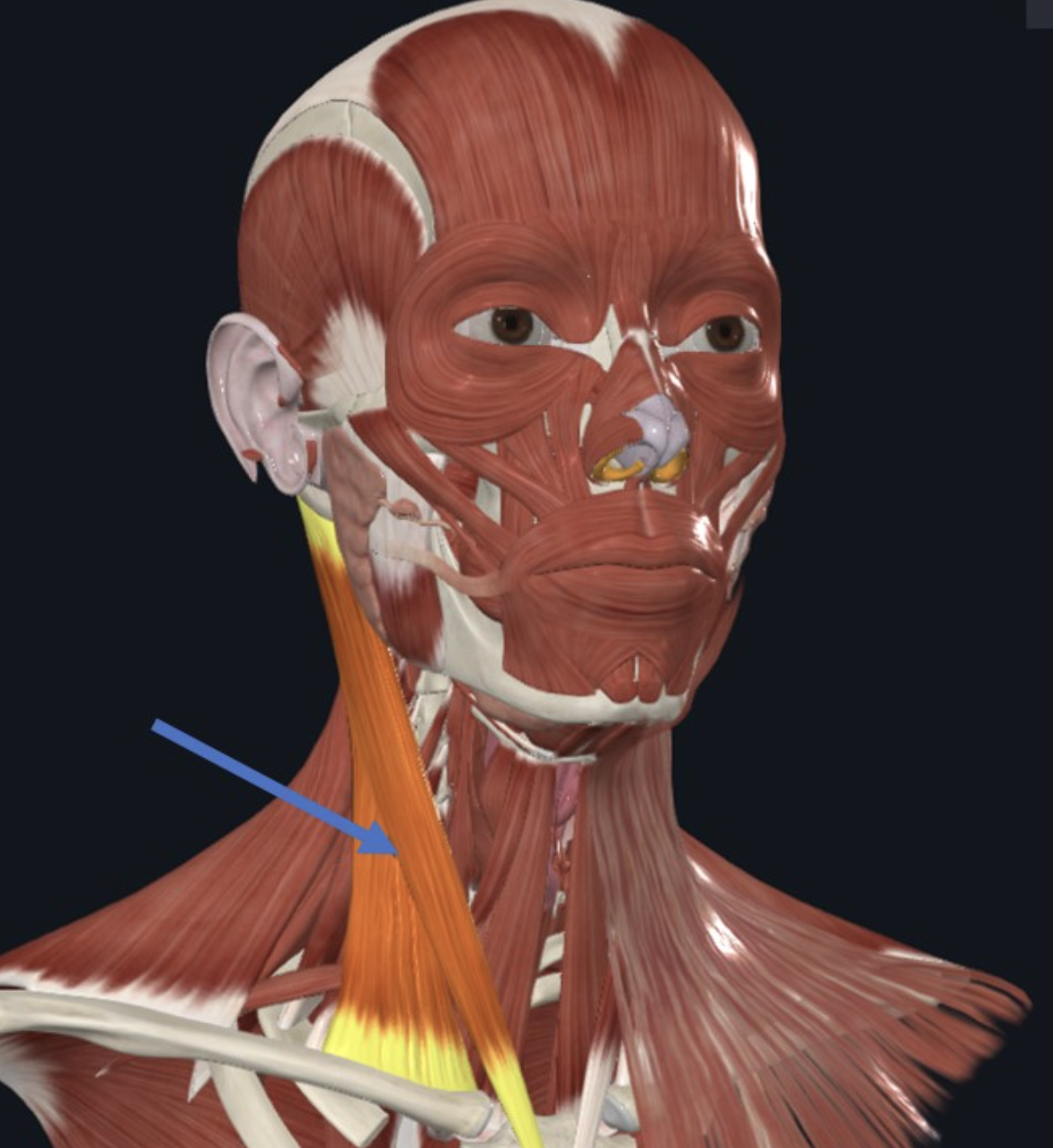 Sternocleidomastoid