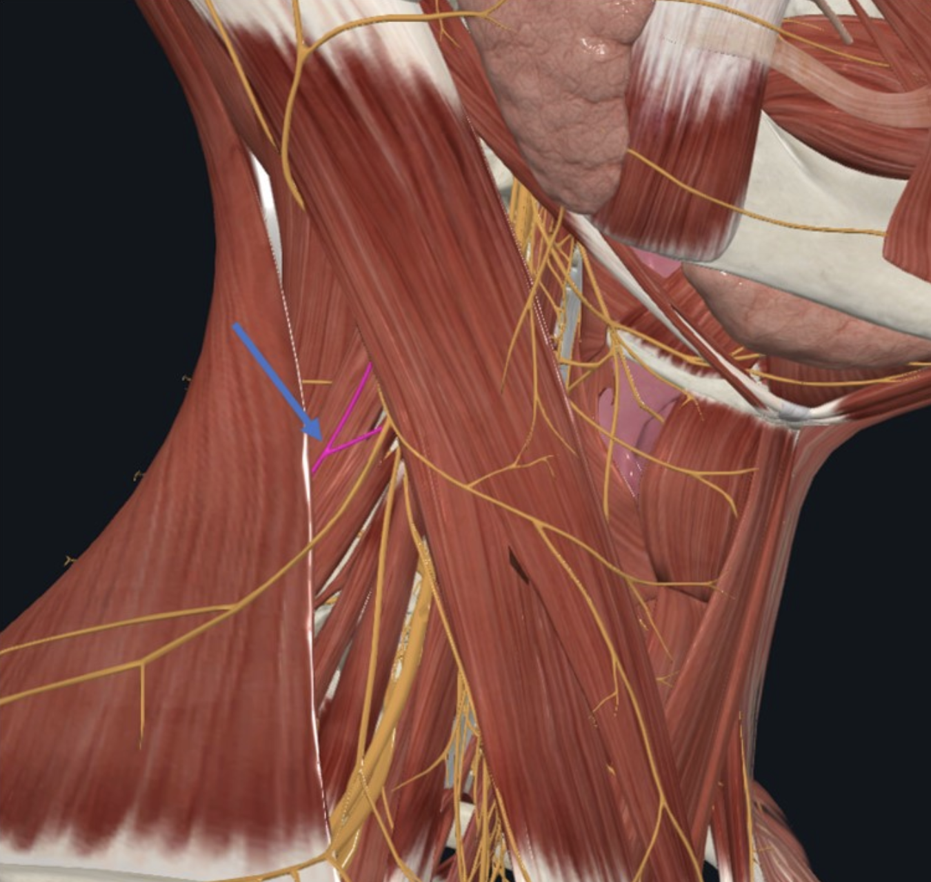 Accessory Nerve, עצב קרניאלי מספר 11 החולף על פני Levator scapula m במשולש הצווארי האחורי