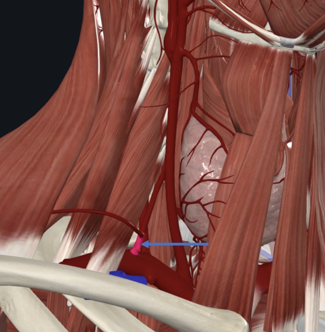 Thyrocervical trunk, מקורו ב־Subclavian והוא מספק מבנים בצוואר ואת בלוטת ה־Thyroid
