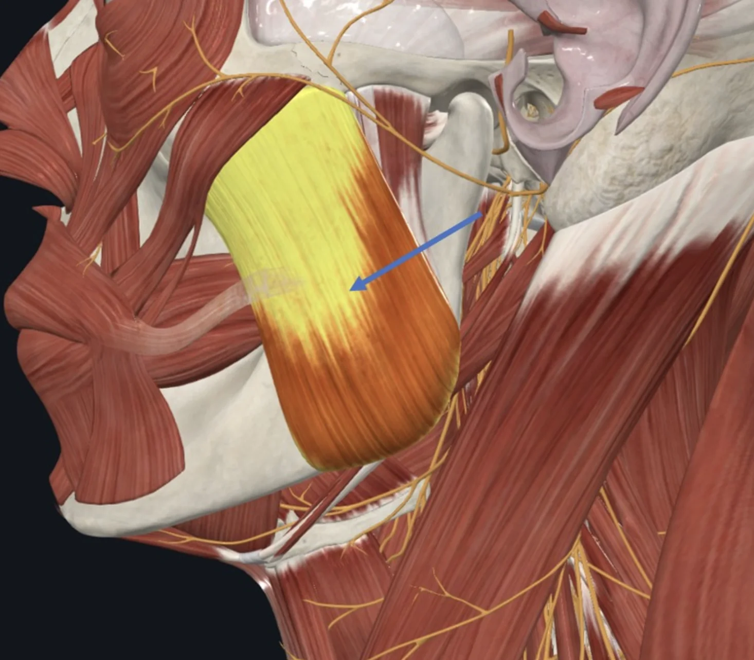Masseter, איננו מצוי ב־Infratemporal fossa אלא במשטח החיצוני של עצם ה־Mandyble