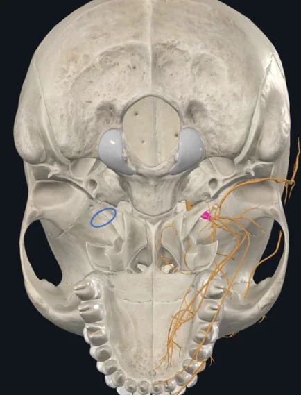 Foramen ovale (מסומן במעגל), וה־Mandibular nerve שבוקע דרכו