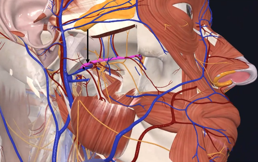 Maxillary Artery