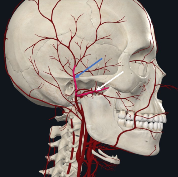 Superficial Temporal Artery, הפיצול הטרמינלי השני של ה־External carotid artery