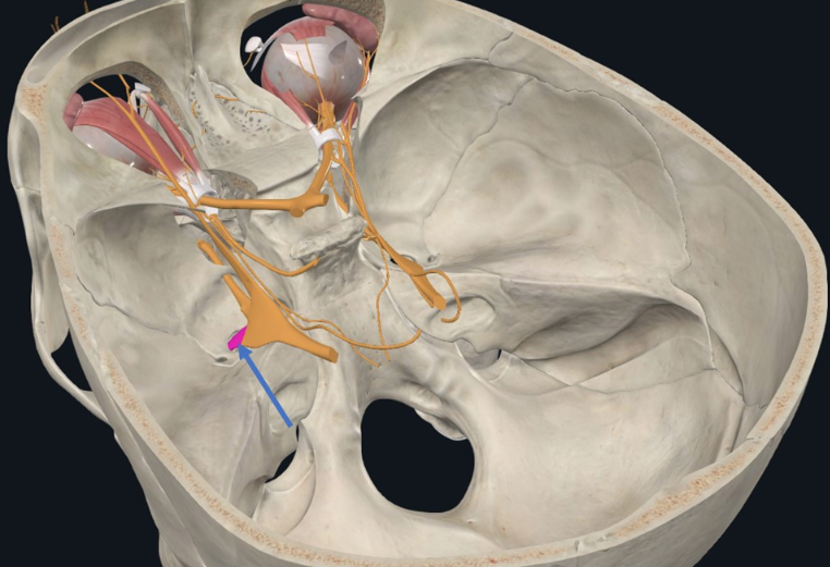 Mandibular Nerve, הענף השלישי של ה־Trigeminal nerve, עוזב דרך Foramen ovale