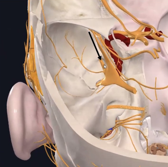 Maxillary nerve, עצב קרניאלי מספר 5, יוצא מחלל הגולגולת דרך ה־Foramen rotundum