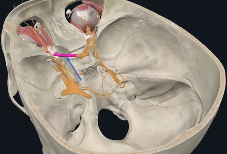 Optic nerve, עצב קרניאלי מספר 2, עוזב את הגולגולת דרך ה־Optic canal