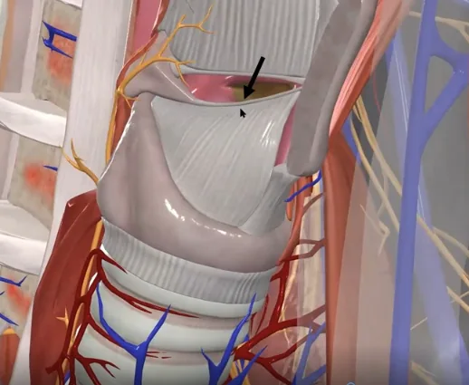 Vocal ligaments - מיתרי הקול