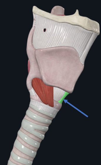 Cricothyroid ligament, רצועה שמקשרת בין סחוסי ה־Cricoid ל־Thyroid. בתמונה מסומן בירוק החלק המדיאני של הרקמה