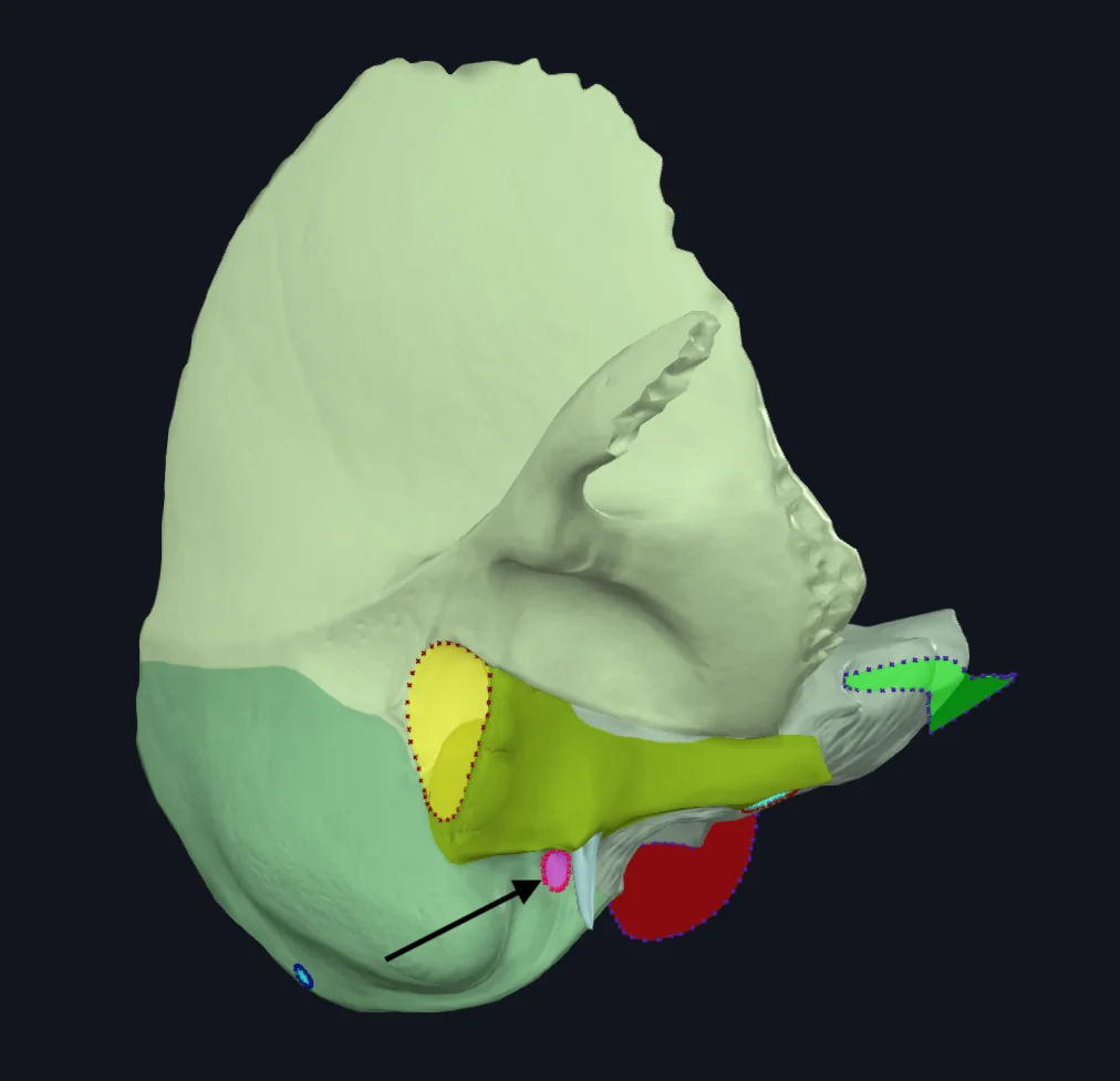 Stylomastoid Foramen