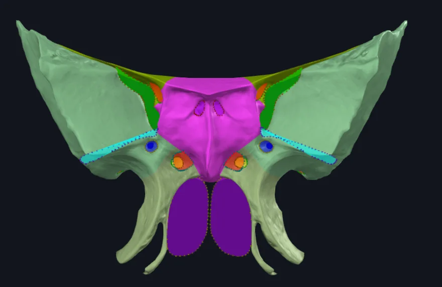 Body of Sphenoid bone