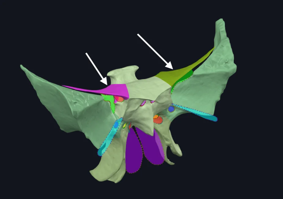 Lesser Wing of Sphenoid bone