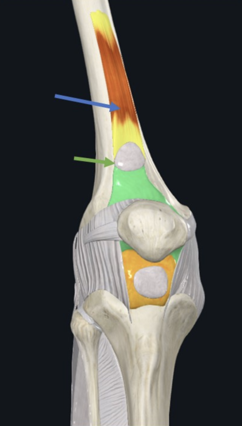 Articularis Genu (חץ כחול), והממברנה הסינוביאלית וה־Suprapatellar Bursa (חץ ירוק)