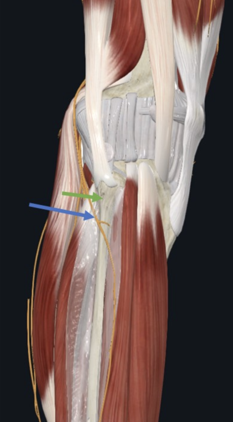 צוואר עצם הפיבולה (חץ ירוק) ועצב ה־Common Fibular (חץ כחול)