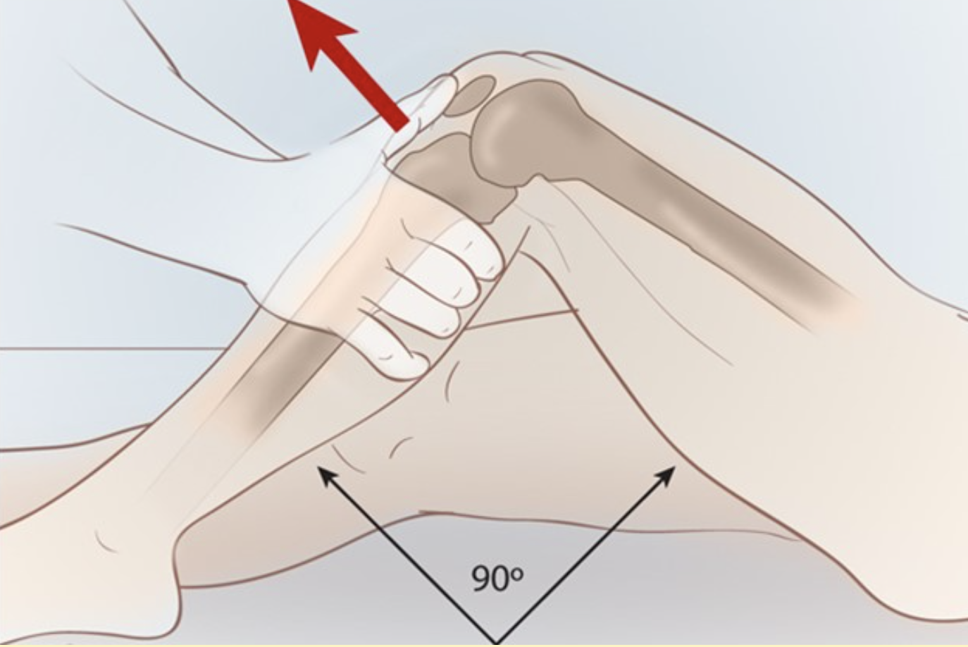 Anterior Drawer Test